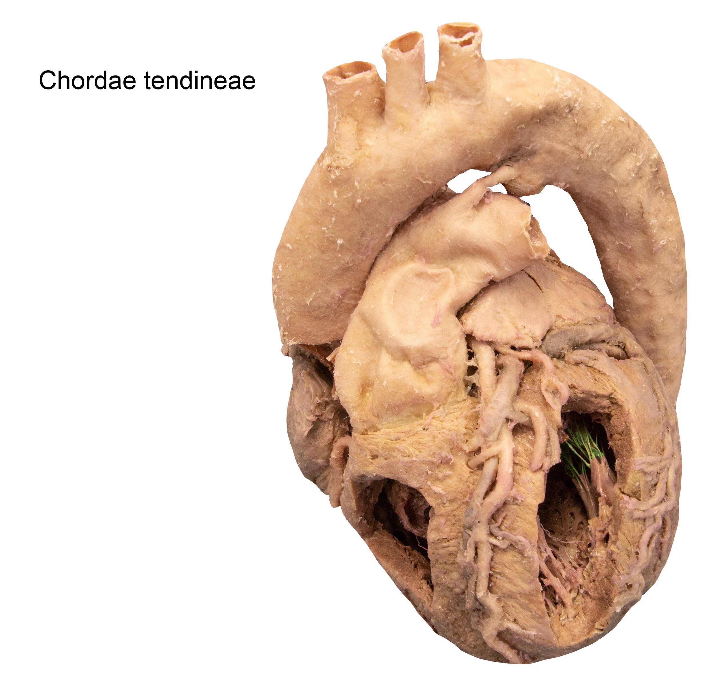 ChordaeTendineae_editedimage_labelled.jpg