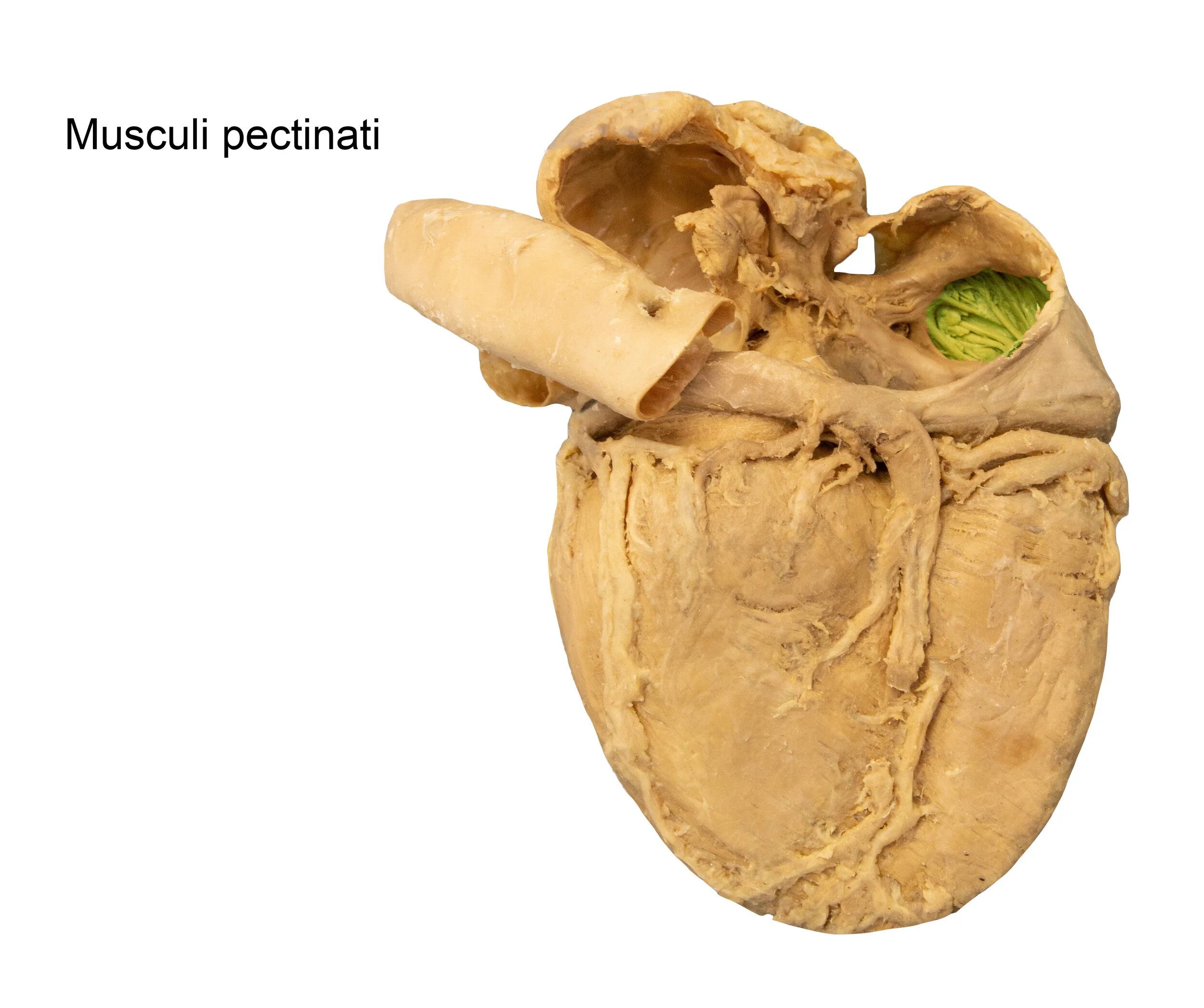 MusculiPectinati_editedimage_labelled.jpg