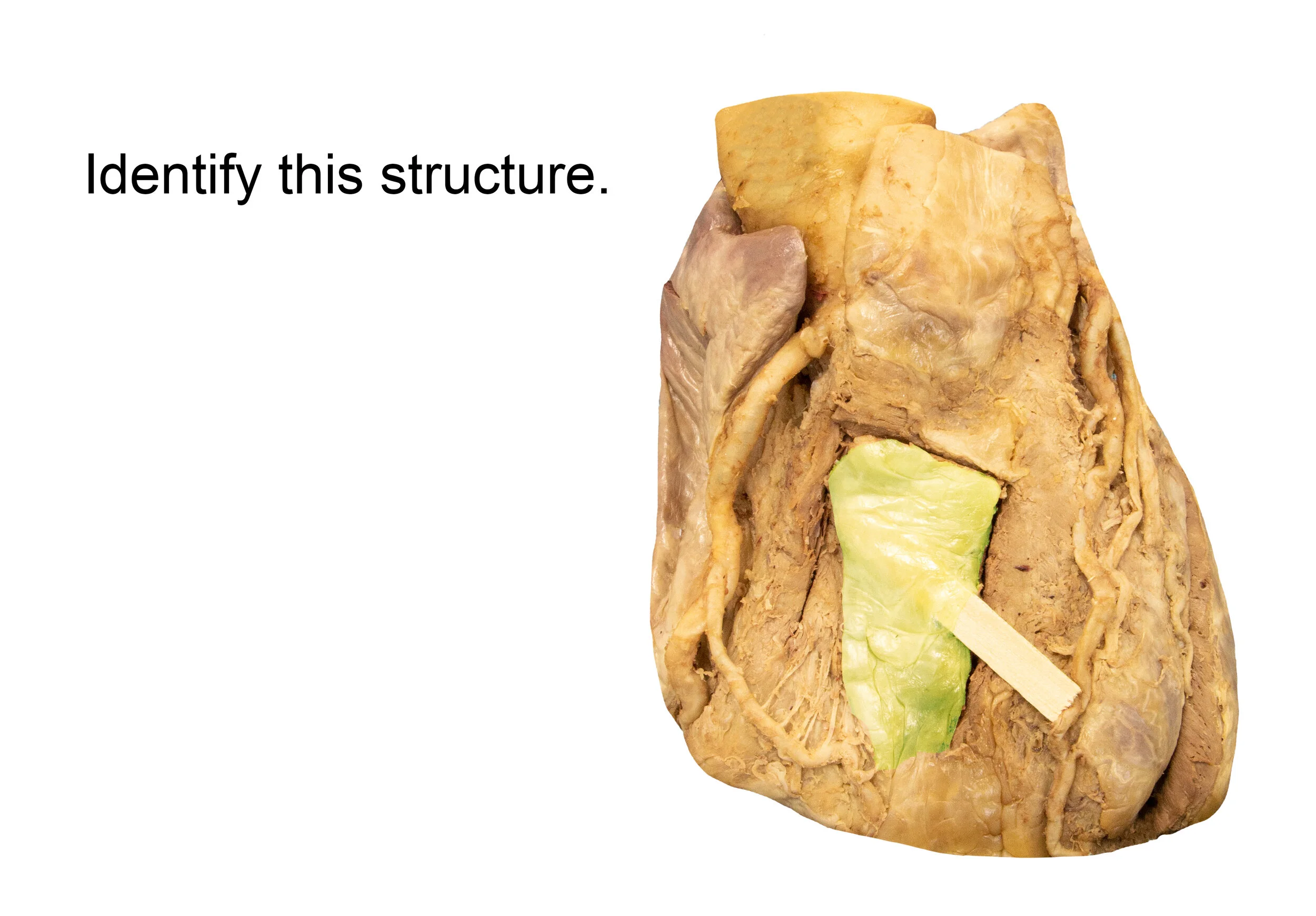 Pericardium_editedimage_identify.jpg