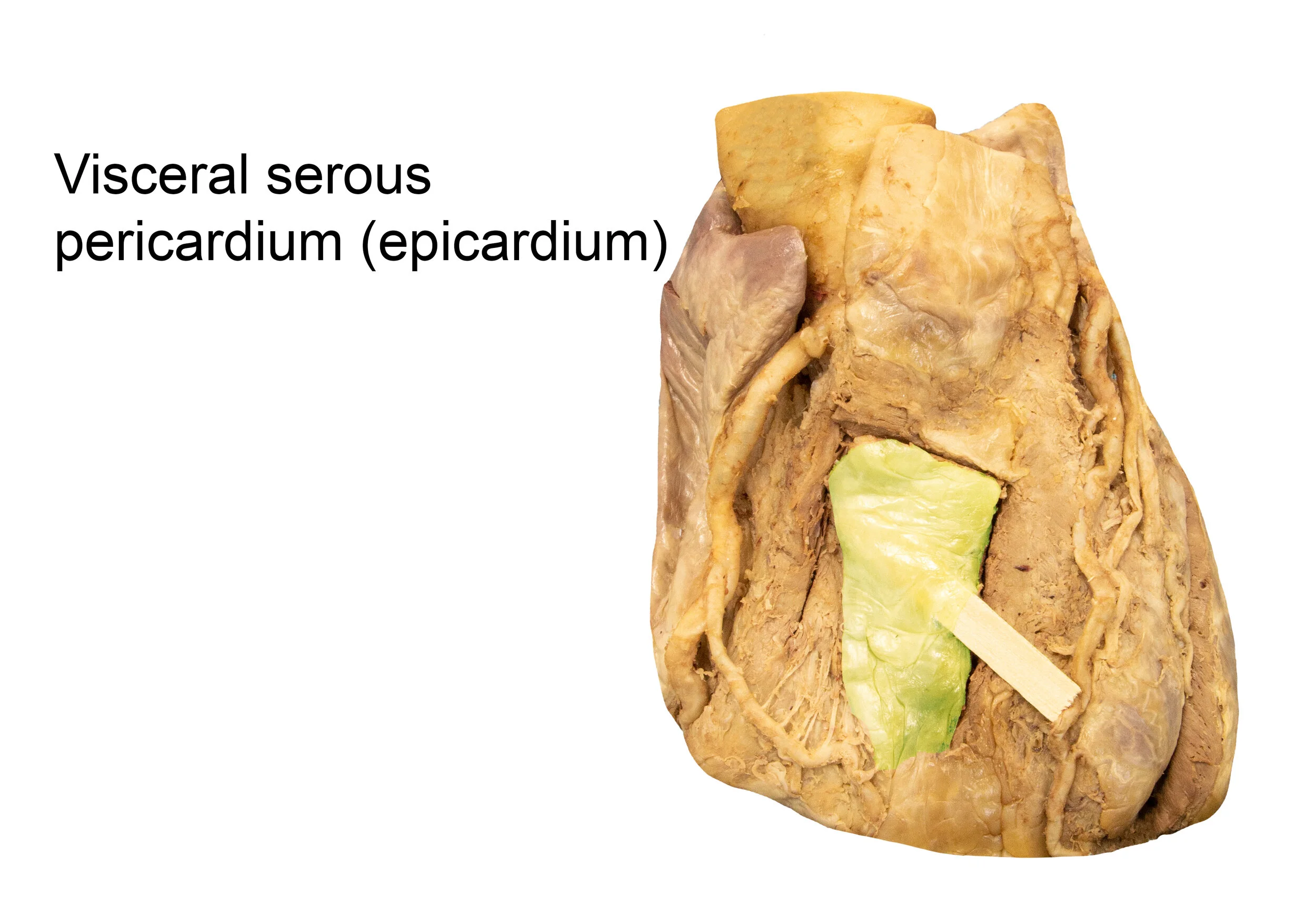 Pericardium_editedimage_labelled.jpg