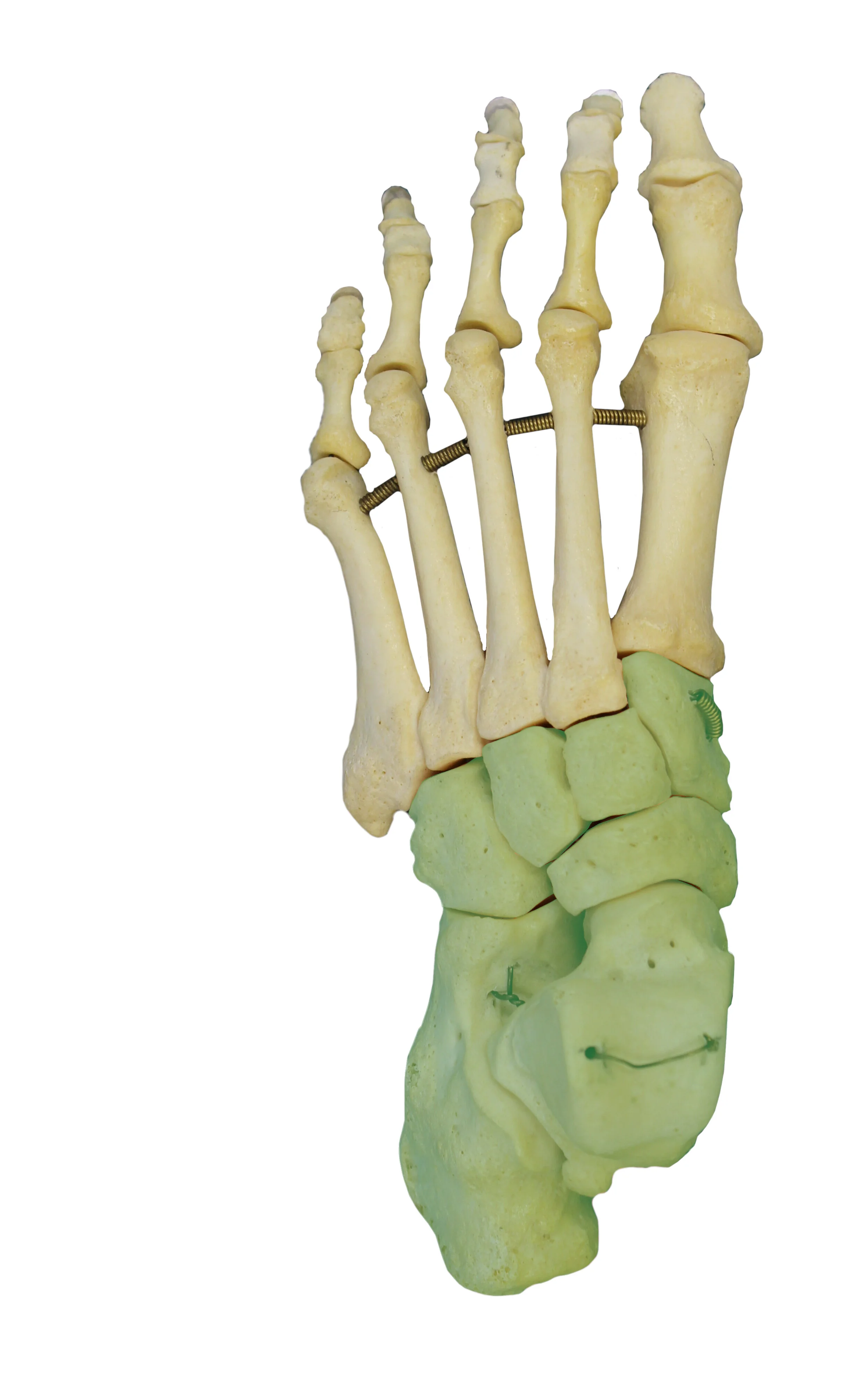 IMG_0650_tarsal_bones_edited_only.jpg