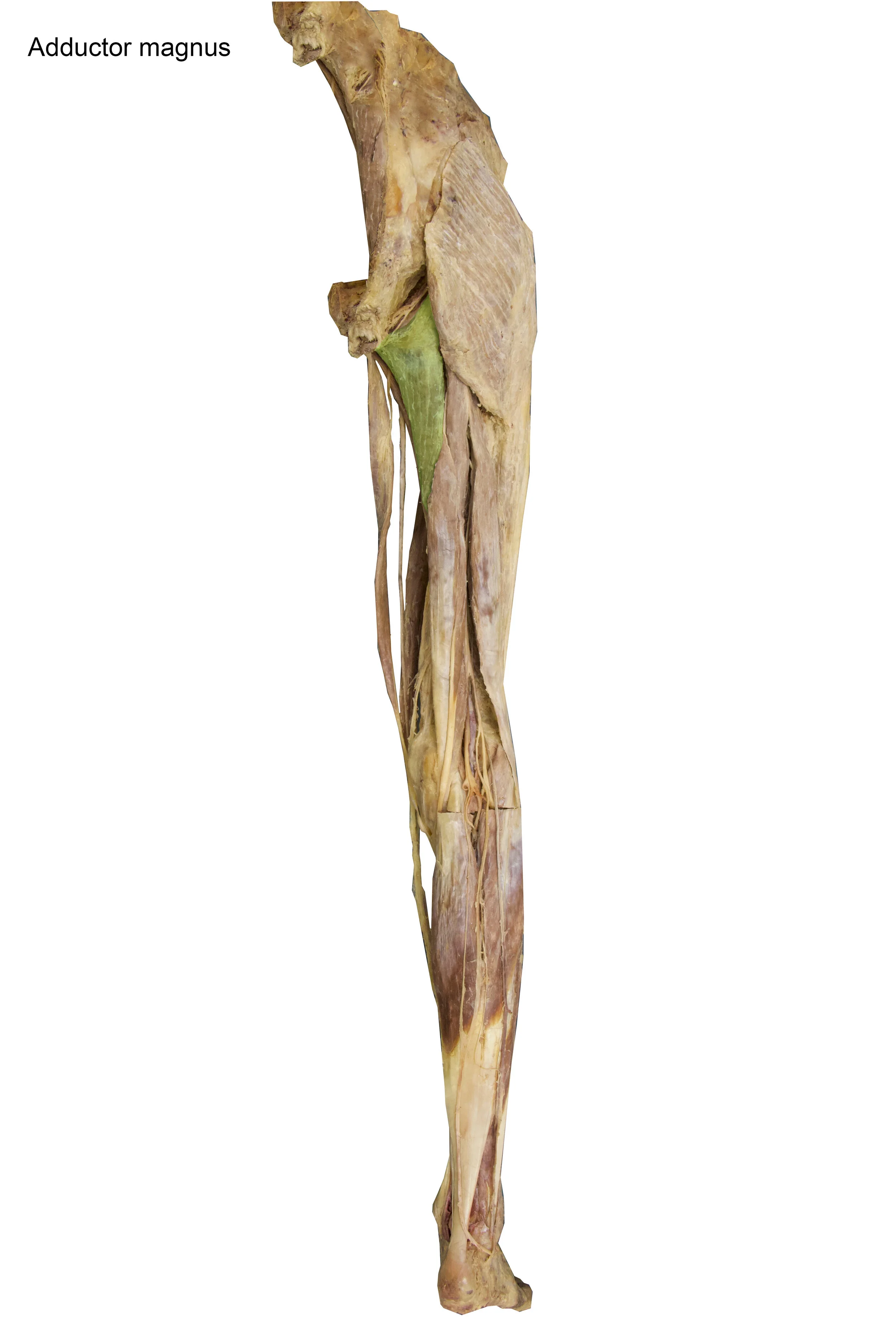 Adductor_magnus_editedimage_labelled.jpg