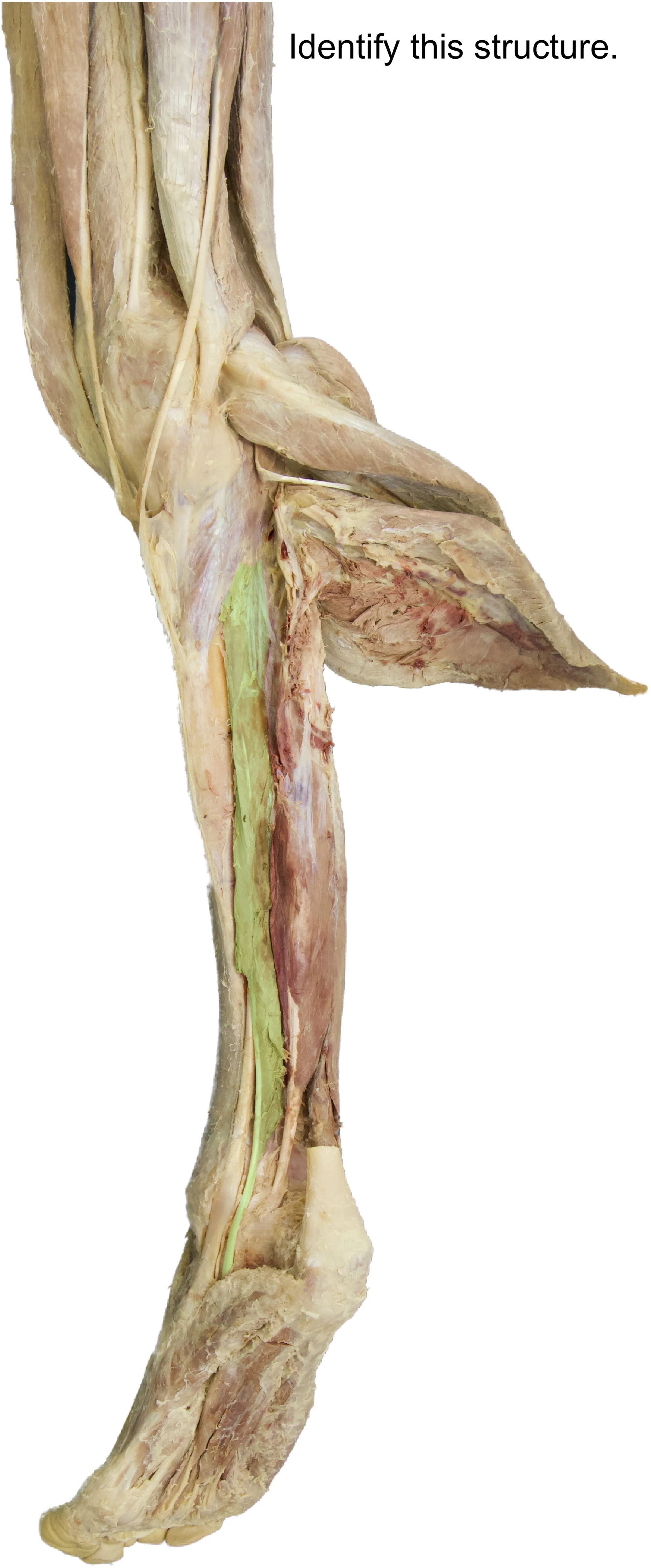 Flexor_digitorum_longus_edited_identify.jpg