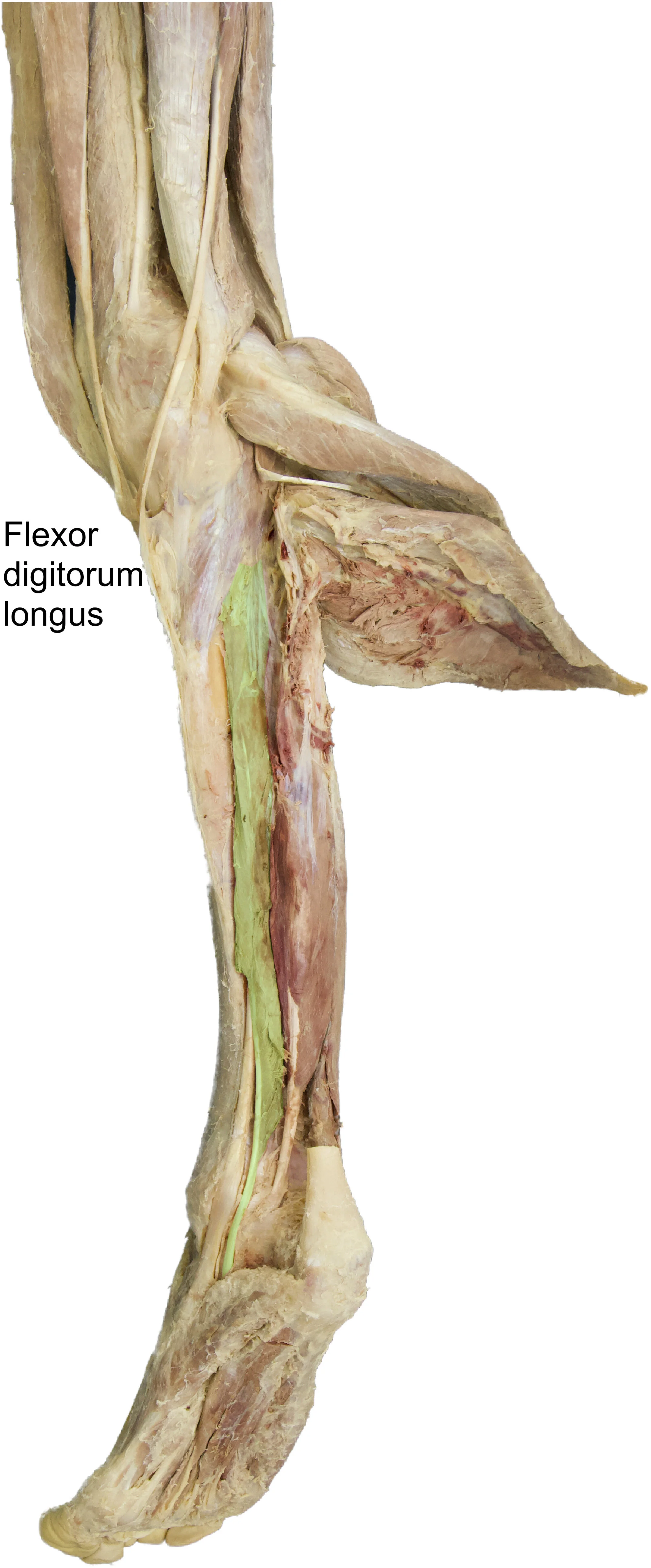 Flexor_digitorum_longus_edited_labelled.jpg