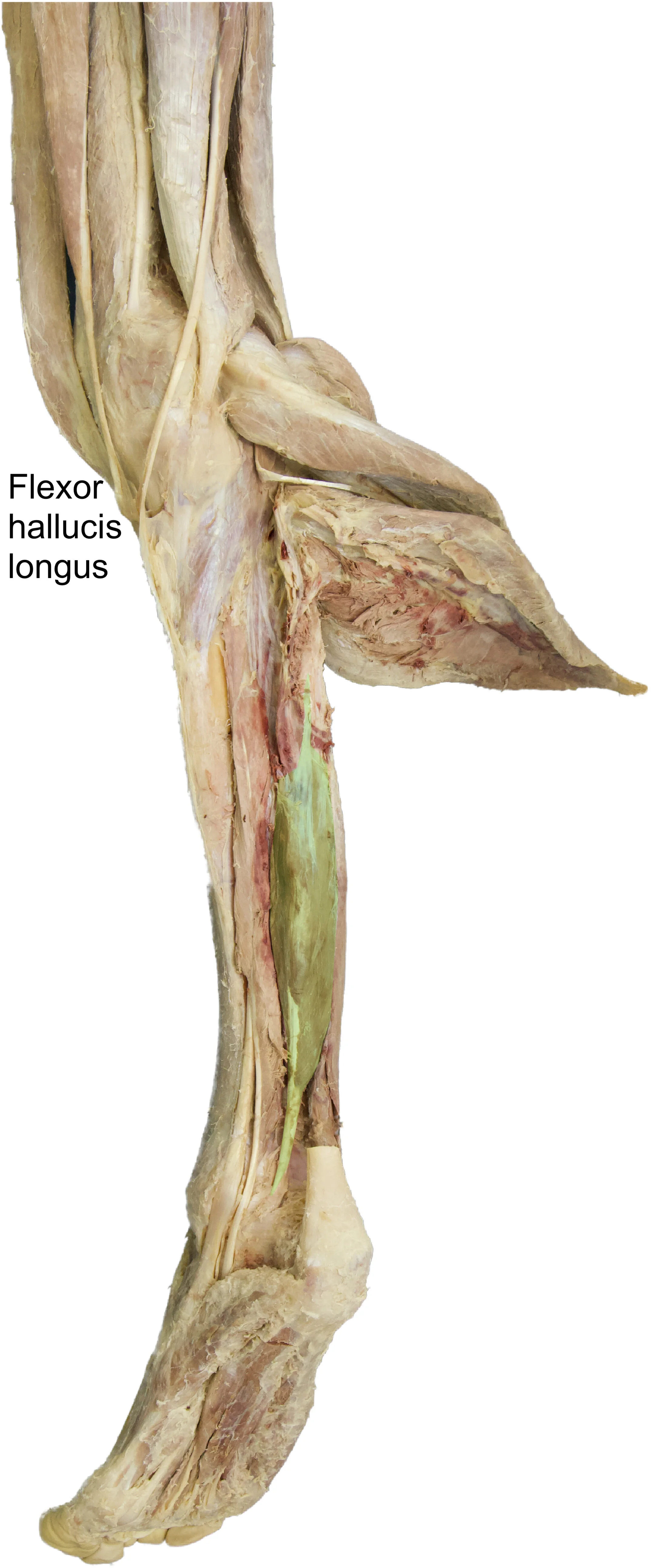 Flexor_hallucis_longus_edited_labelled.jpg