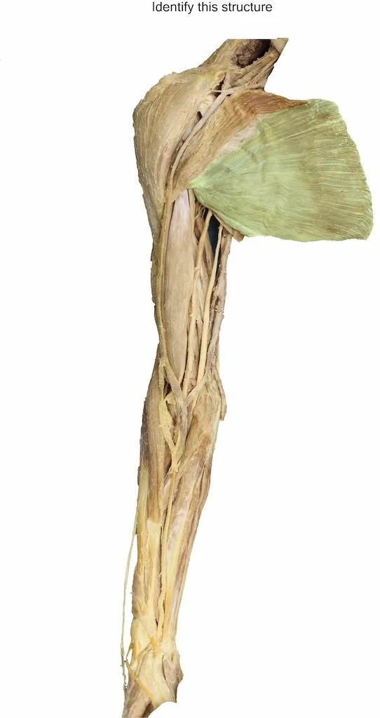 PectoralisMajorSternal_editedimage_identify.jpg