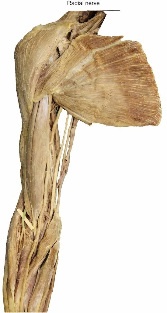 RadialNerve_editedimage_labelled.jpg