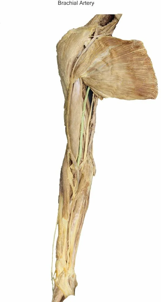BrachialArtery_editedimage_labelled.jpg