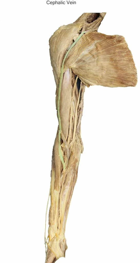 CephalicVein_editedimage_labelled.jpg