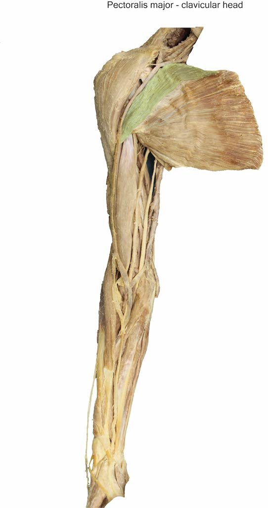 PectoralisMajorClavicular_editedimage_labelled.jpg