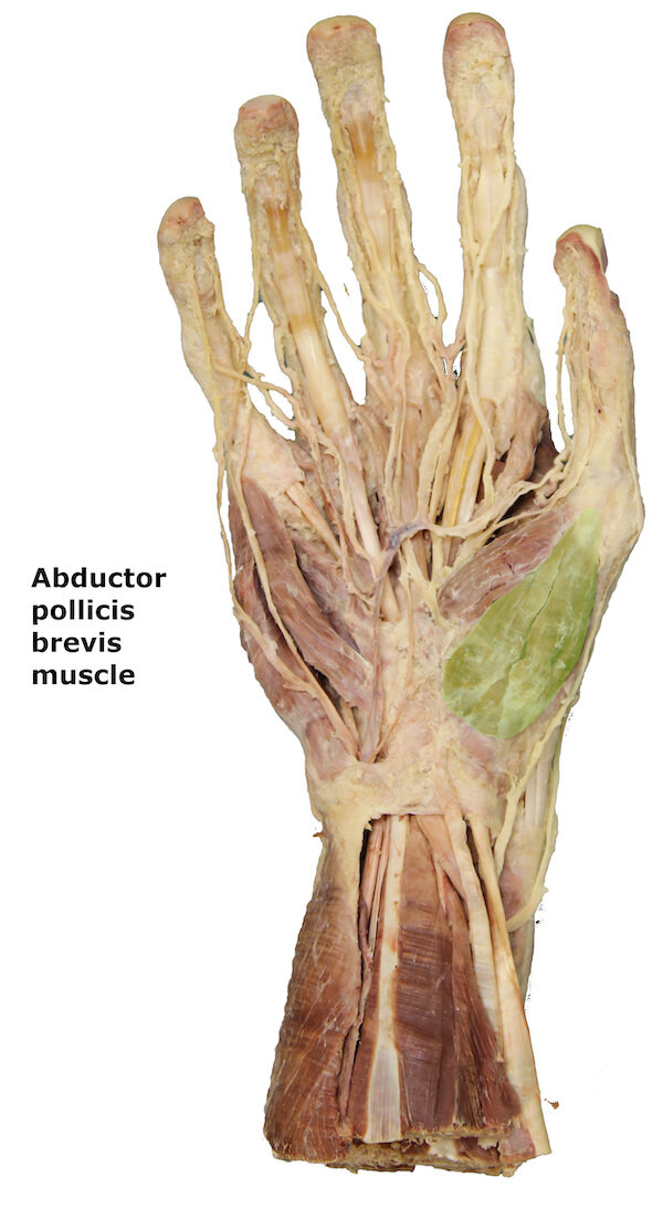 Abductor pollicis brevis muscle_editedimage_labelled.jpg