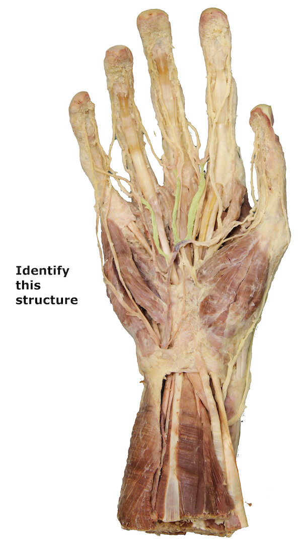 Common palmar digital arteries_editedimage_identify.jpg