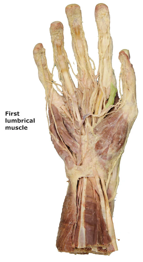 First lumbrical muscle_editedimage_labelled.jpg