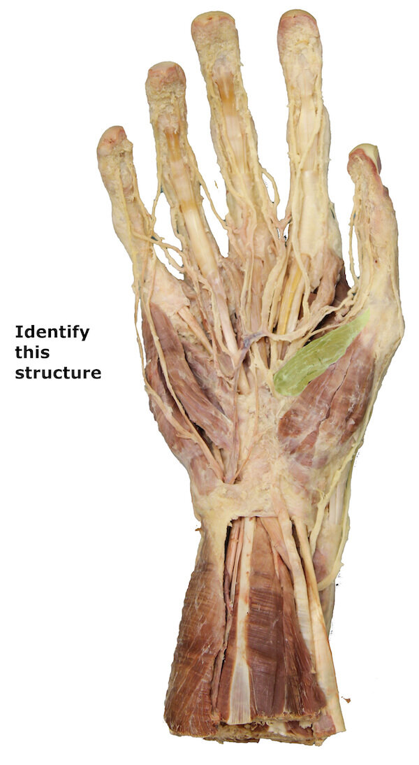 Flexor pollicis brevis muscle_editedimage_identify.jpg