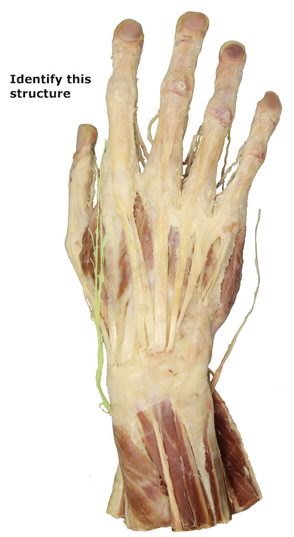 Superficial branch of radial nerve_editedimage_identify.jpg