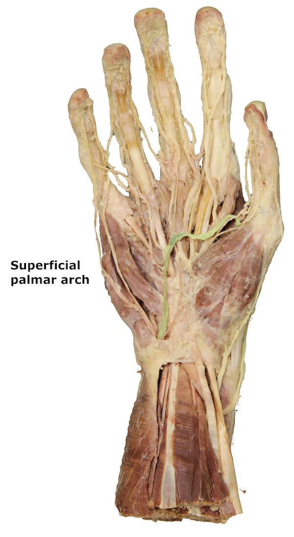 Superficial palmar arch_editedimage_labelled.jpg