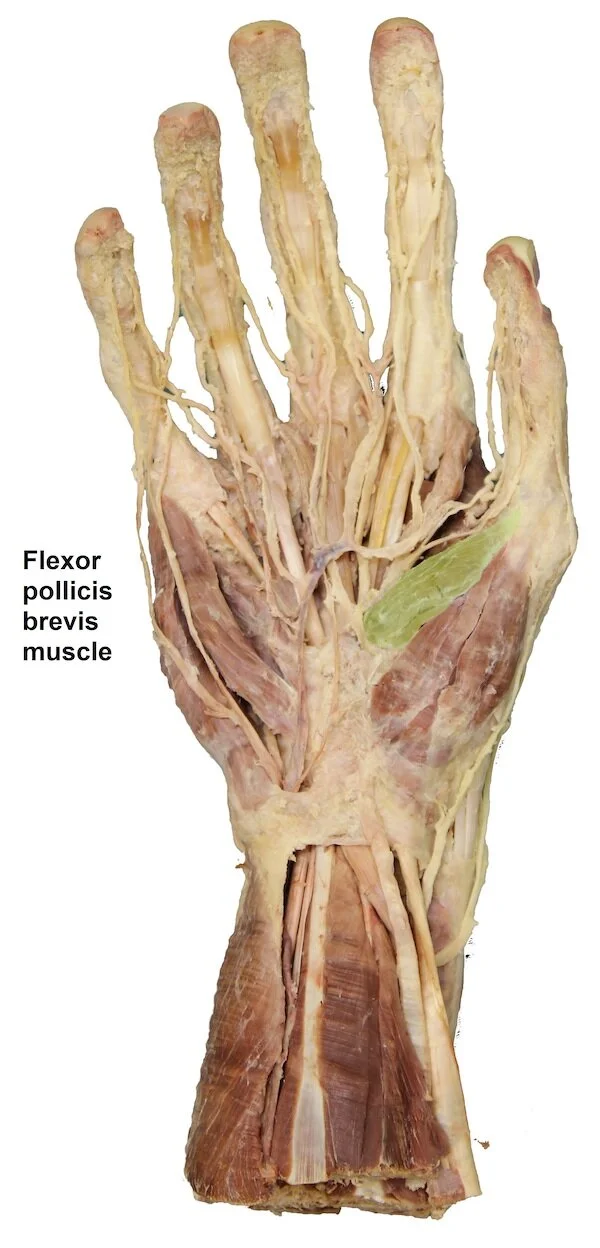 Flexor pollicis brevis muscle_editedimage_labelled.jpg