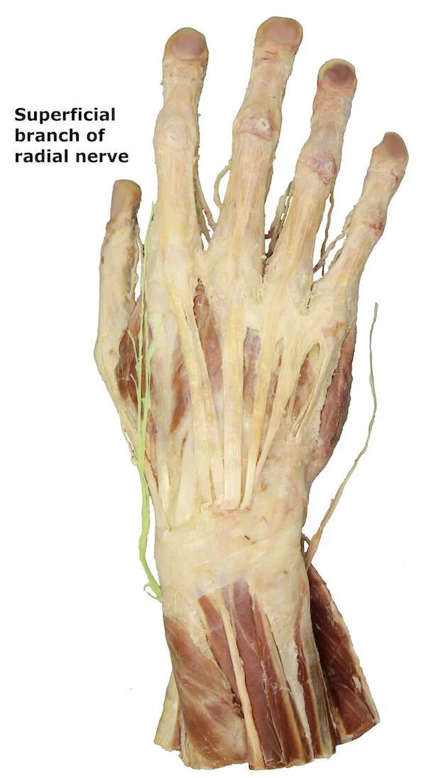 Superficial branch of radial nerve_editedimage_labelled.jpg