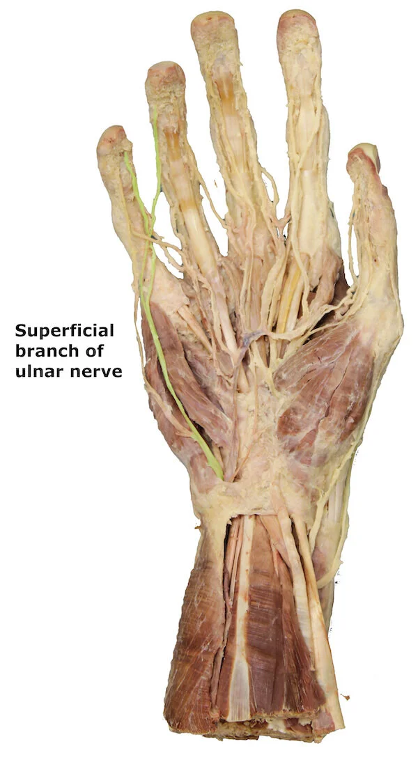 Superficial branch of ulnar nerve_editedimage_labelled.jpg
