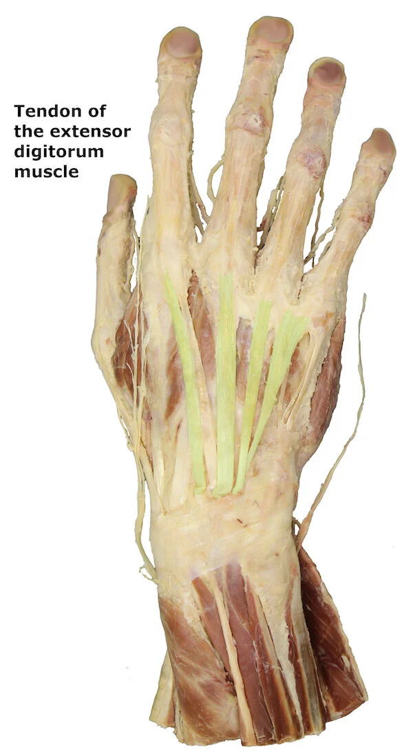 Tendon of the extensor digitorum muscle_editedimage_labelled.jpg