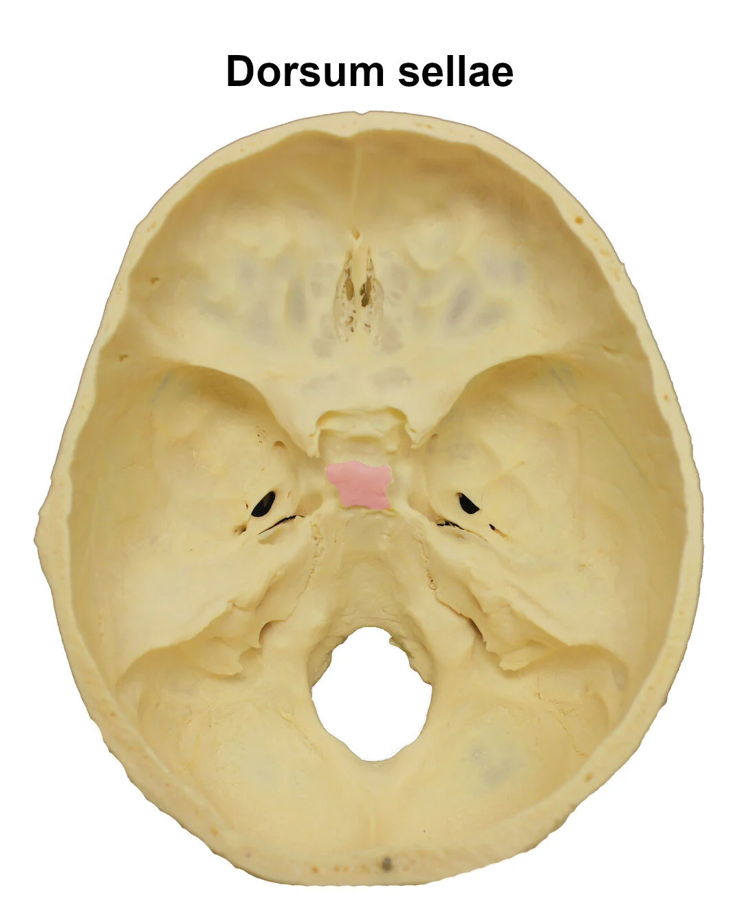 dorsumsellae_editedimage_labelled.jpg