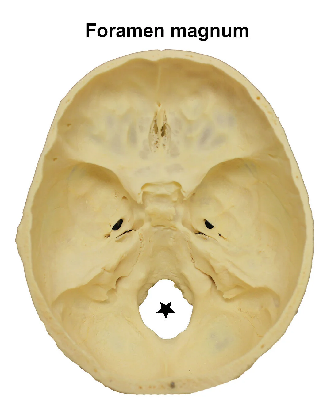 foramenmagnum_editedimage_labelled.jpg