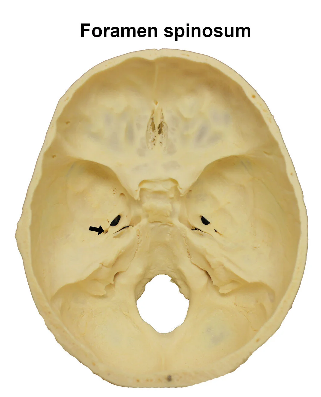 foramenspinosum_editedimage_labelled.jpg