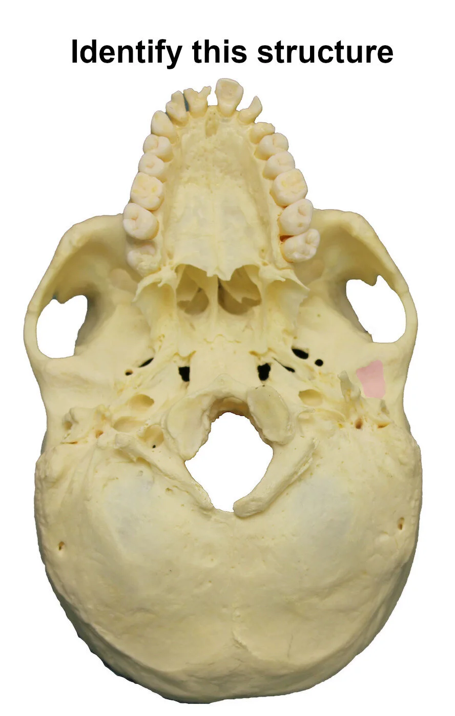 mandibularfossa_editedimage_identify.jpg