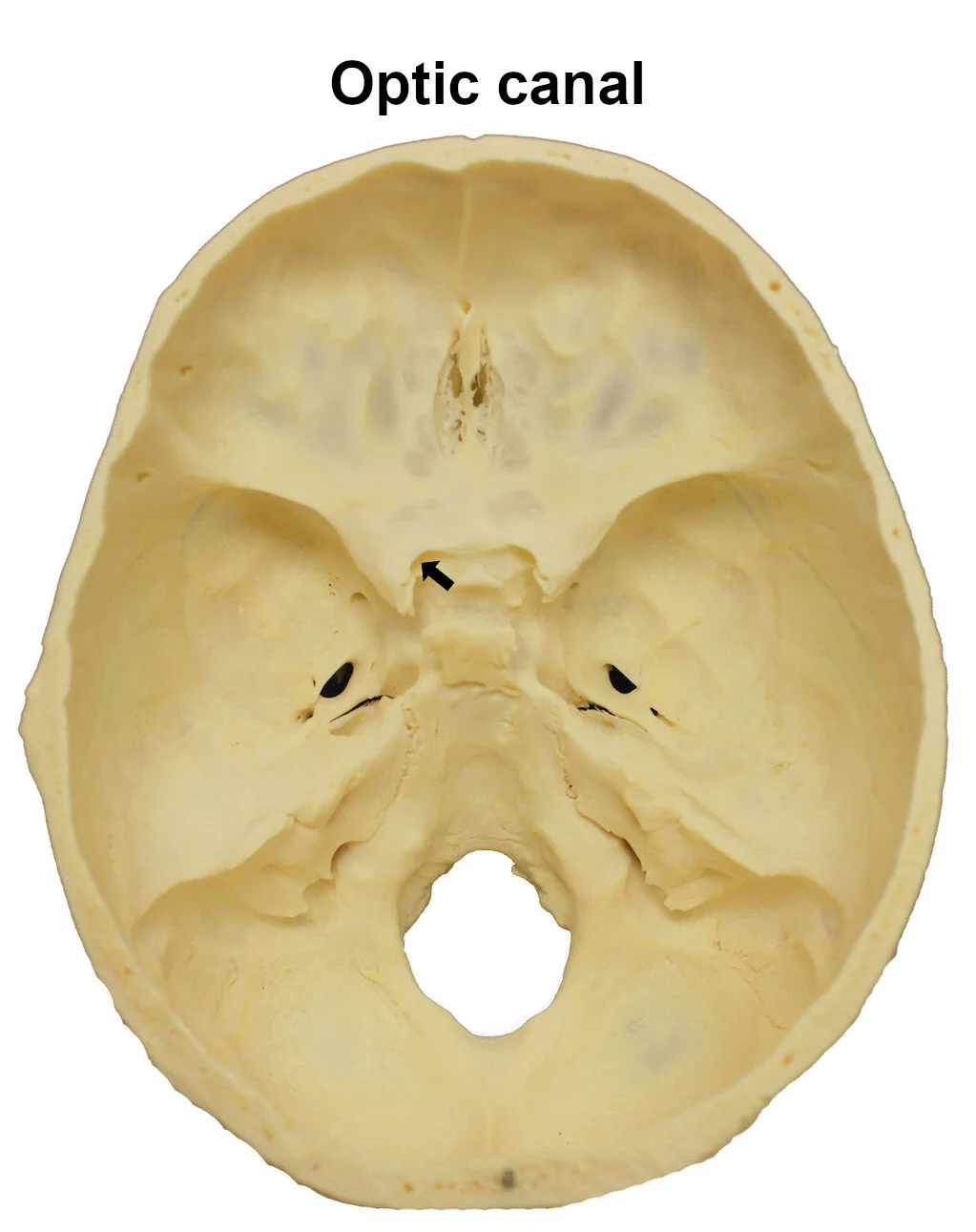 opticcanal_editedimage_labelled.jpg