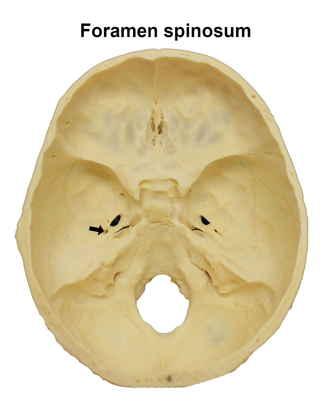 foramenspinosum_editedimage_labelled.jpg