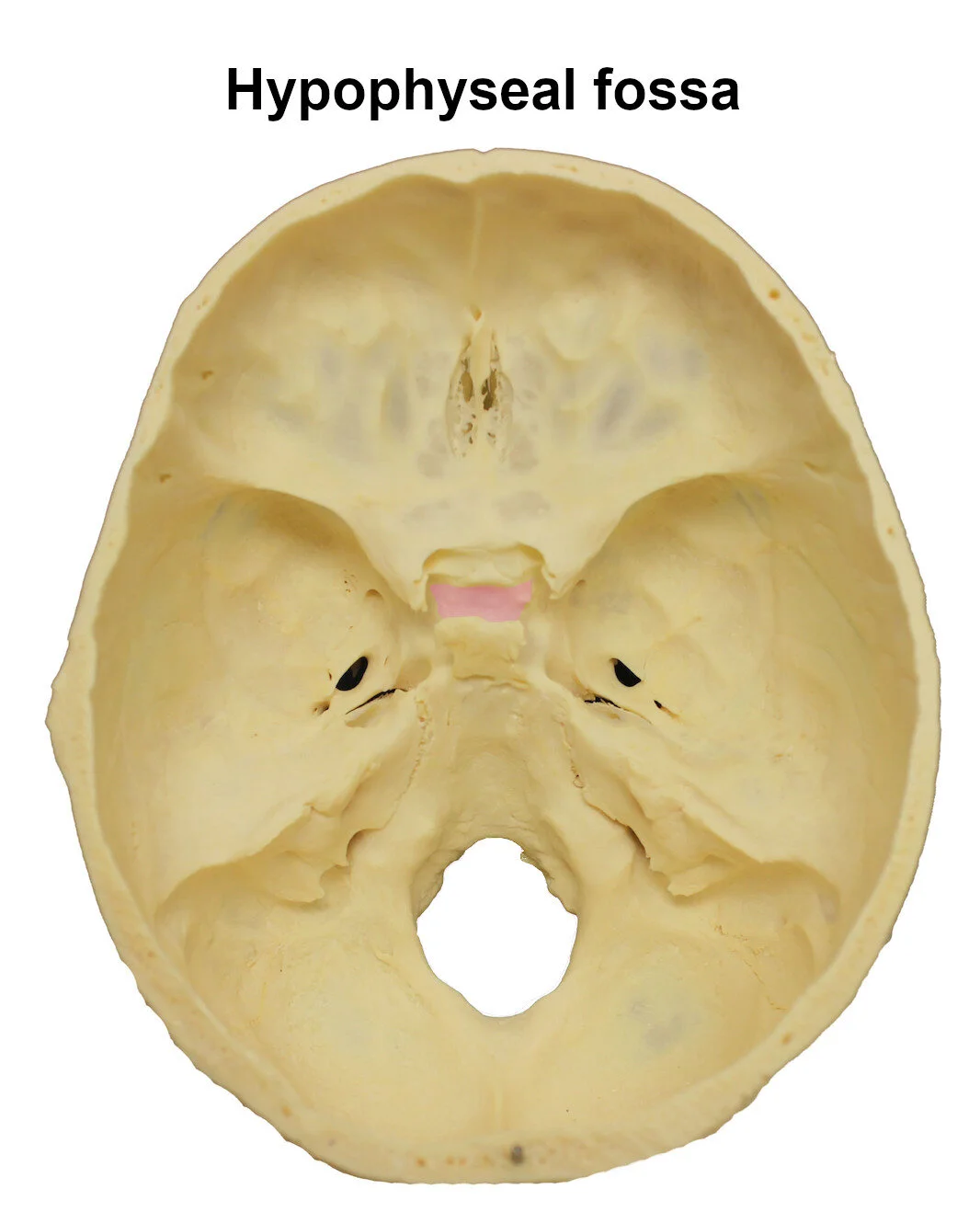 hypophysealfossa_editedimage_labelled.jpg
