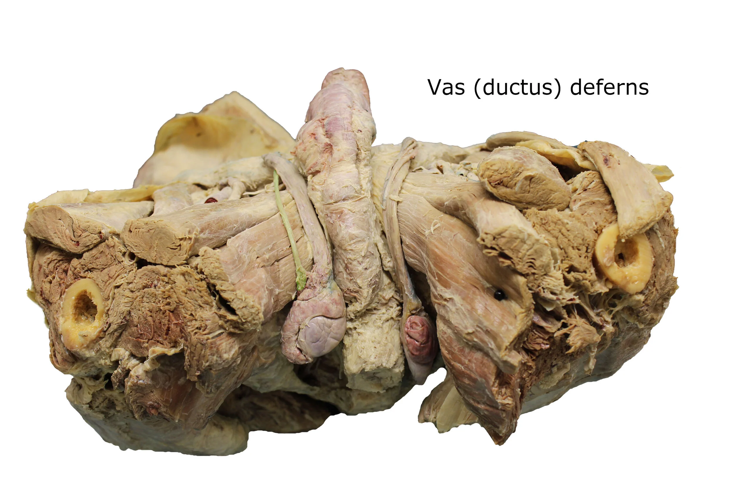 Vas_(ductus)_deferns_editedimage_labelled.jpg