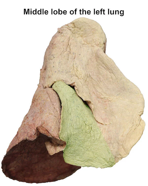 middlelobeofleftlung_editedimage_labelled.jpg