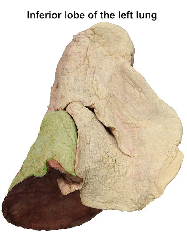 inferiorlobeofleftlung_editedimage_labelled.jpg