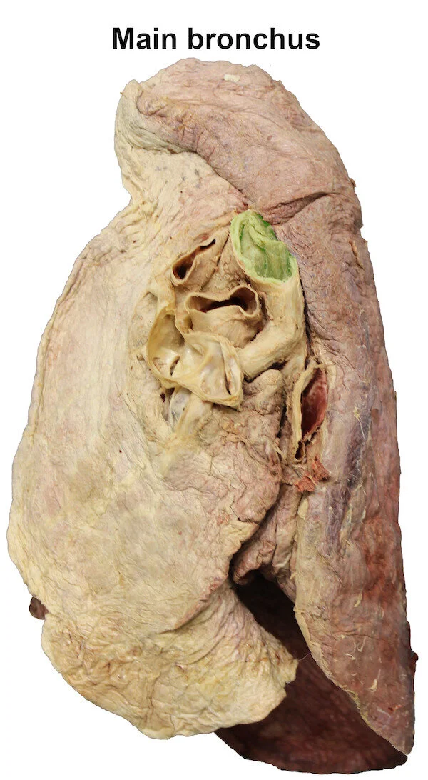 mainbronchus_editedimage_labelled.jpg