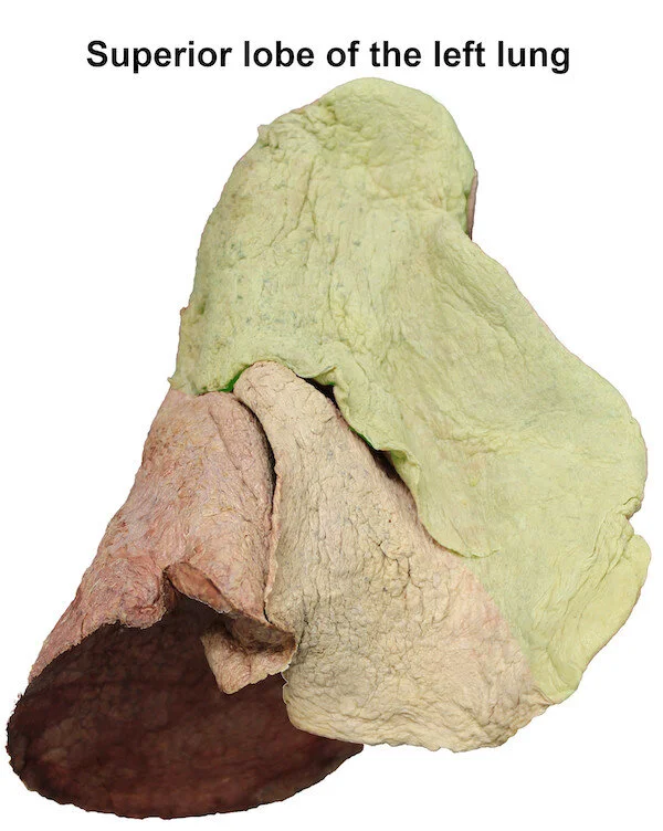 superiorlobeofleftlung_editedimage_labelled.jpg