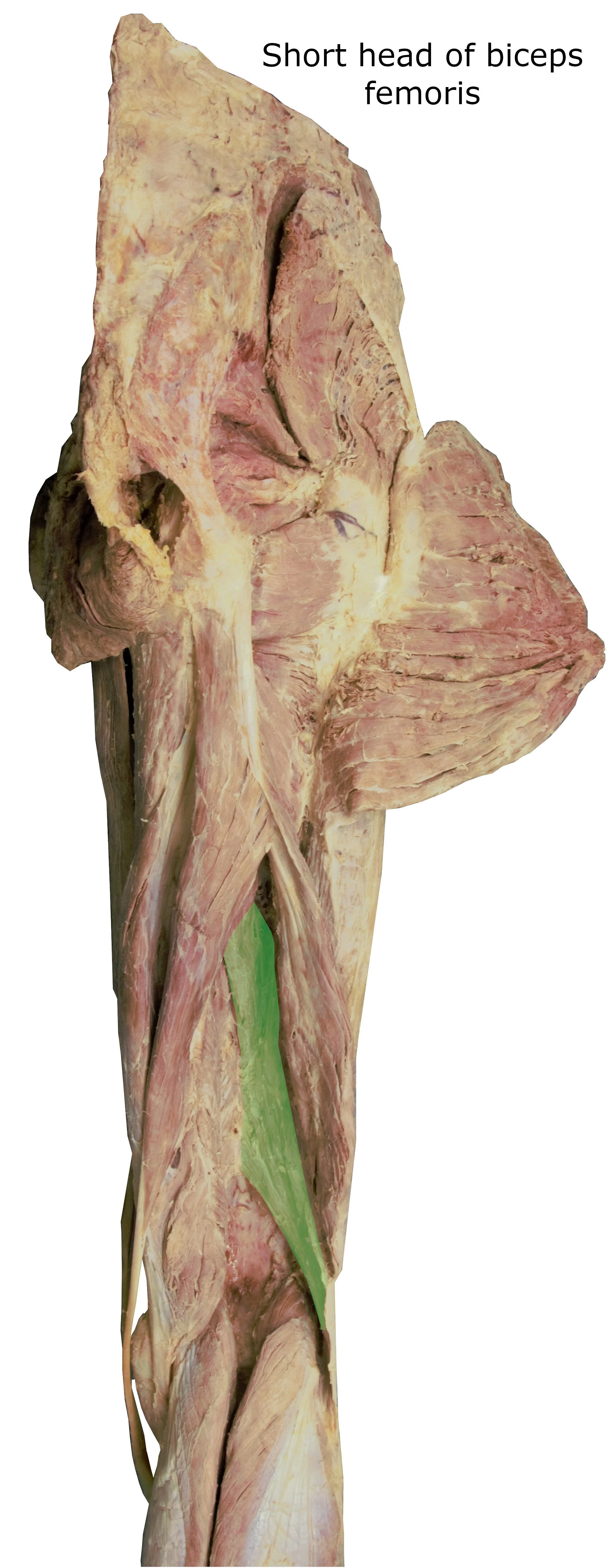 Shortheadofbicepsfemoris_editedimage_labelled.jpg