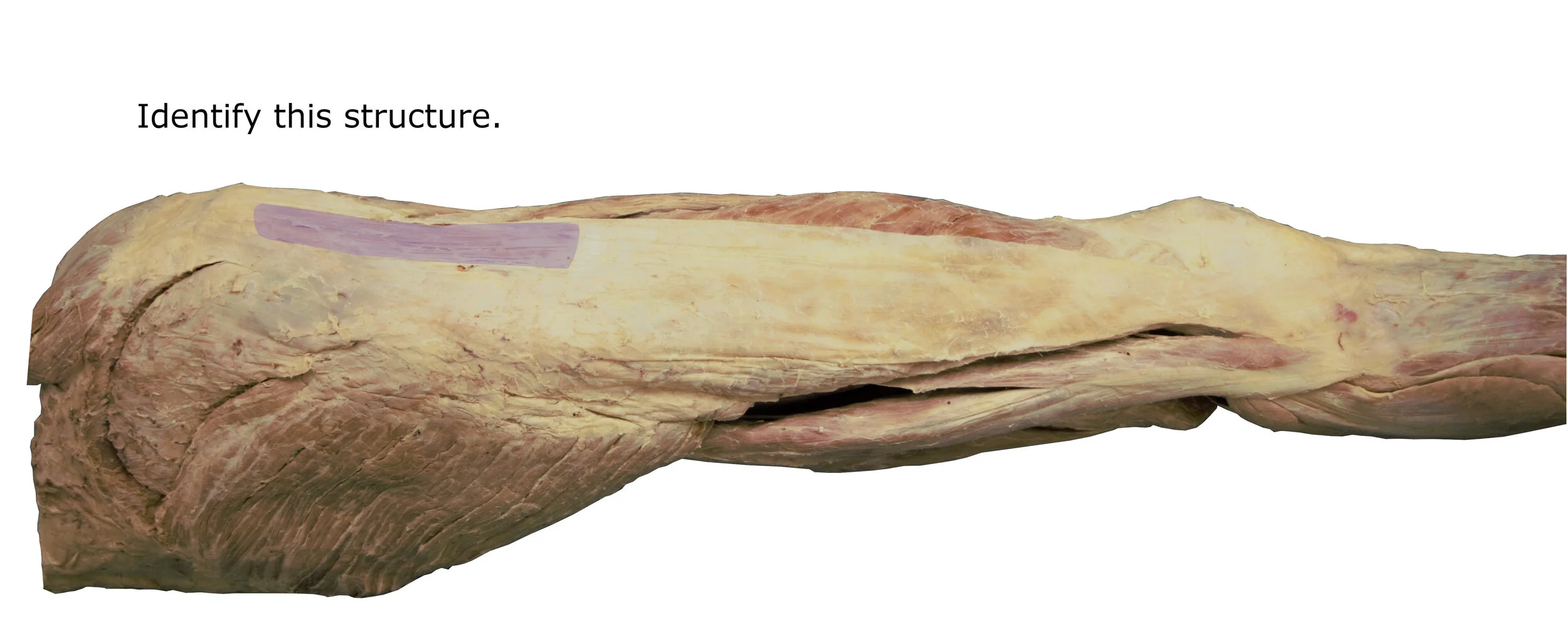 Tensorfascialata_editedimage_identify.jpg