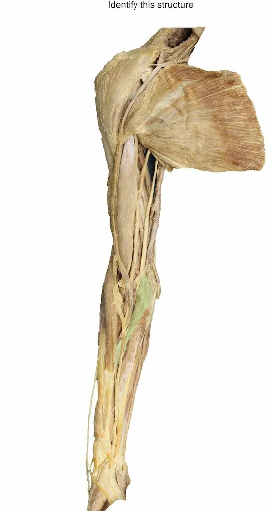 PronatorTeres_editedimage_identify.jpg