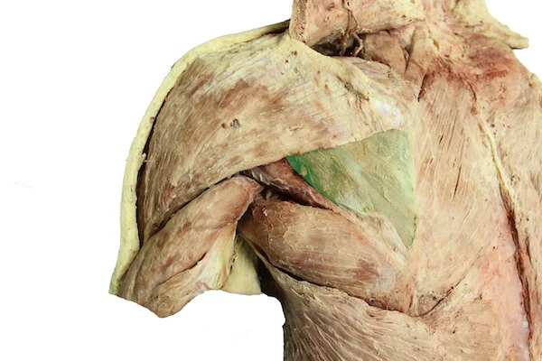 Infraspinatus muscle_editedimage.JPG