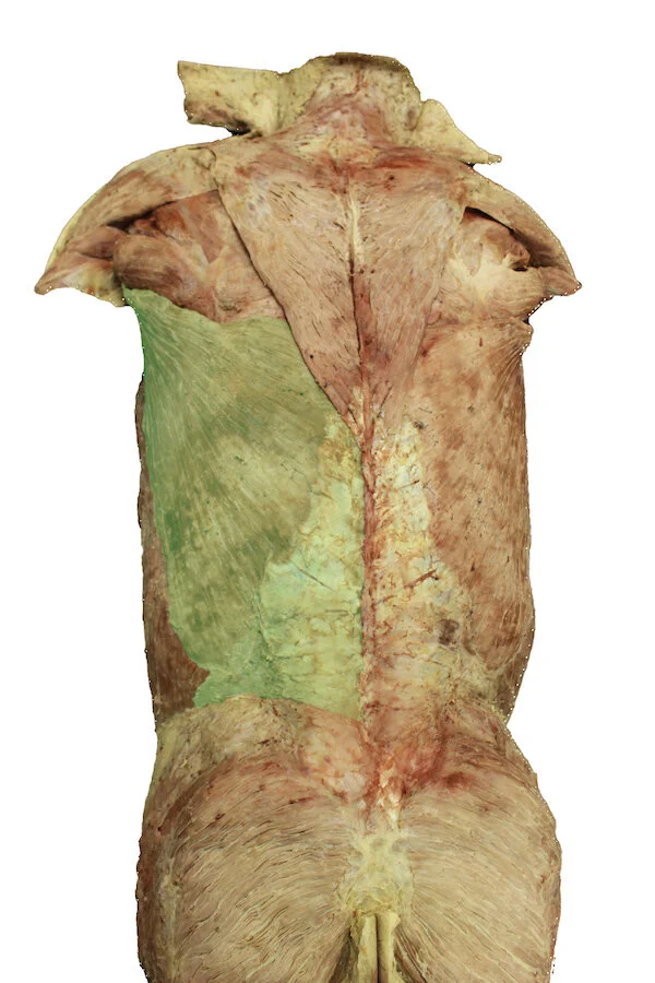 Latissimus dorsi muscle_editedimage.JPG