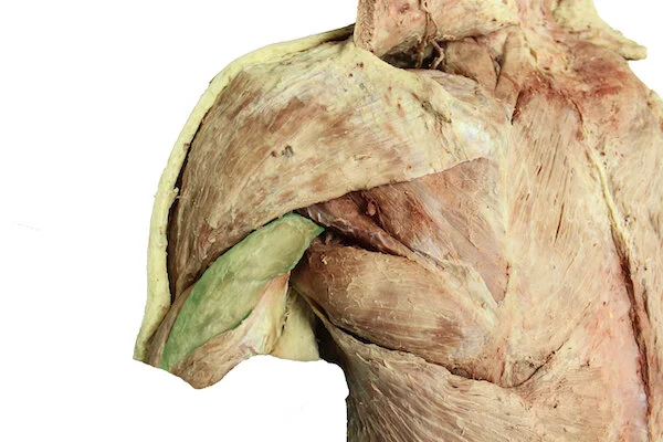 Long head of triceps muscle_editedimage.JPG