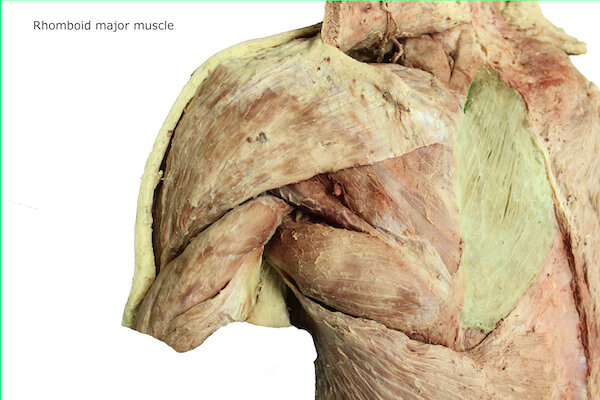 Rhomboid major muscle_editedimage_labelled.JPG