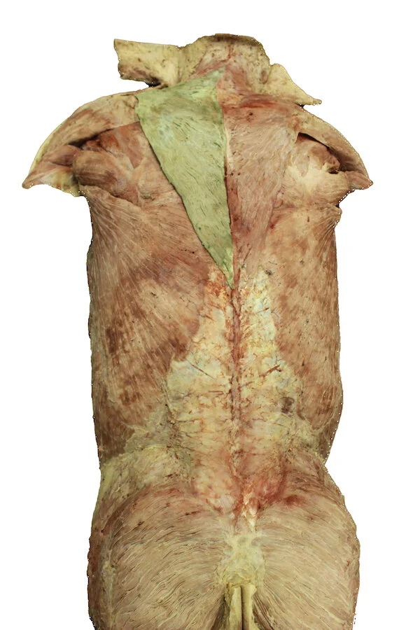 Trapezius muscle_editedimage.JPG