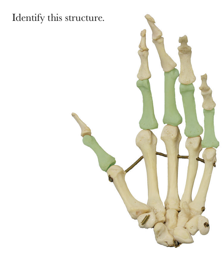proximal_phalanges_identify.jpg