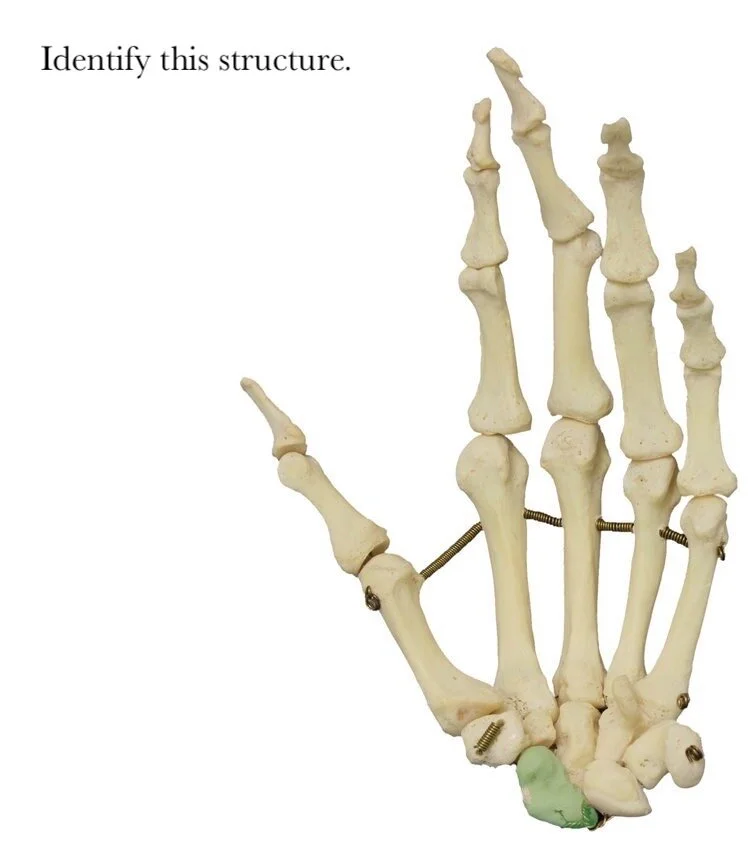 scaphoid_bone_identify.JPG