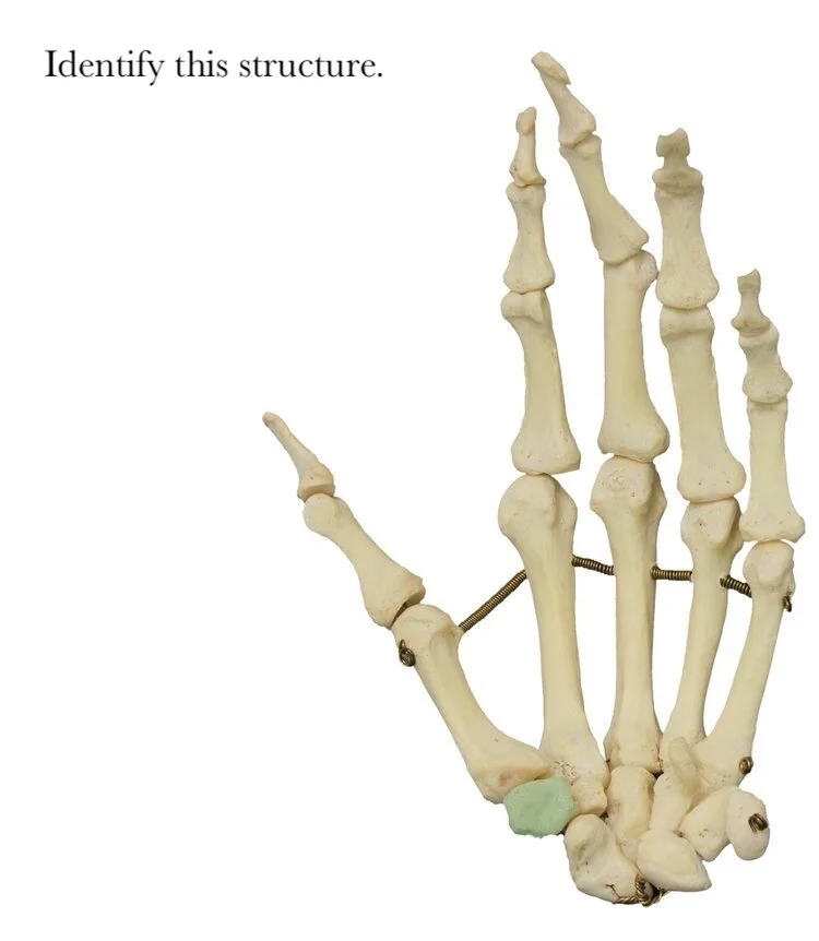 trapezium_bone_identify.JPG