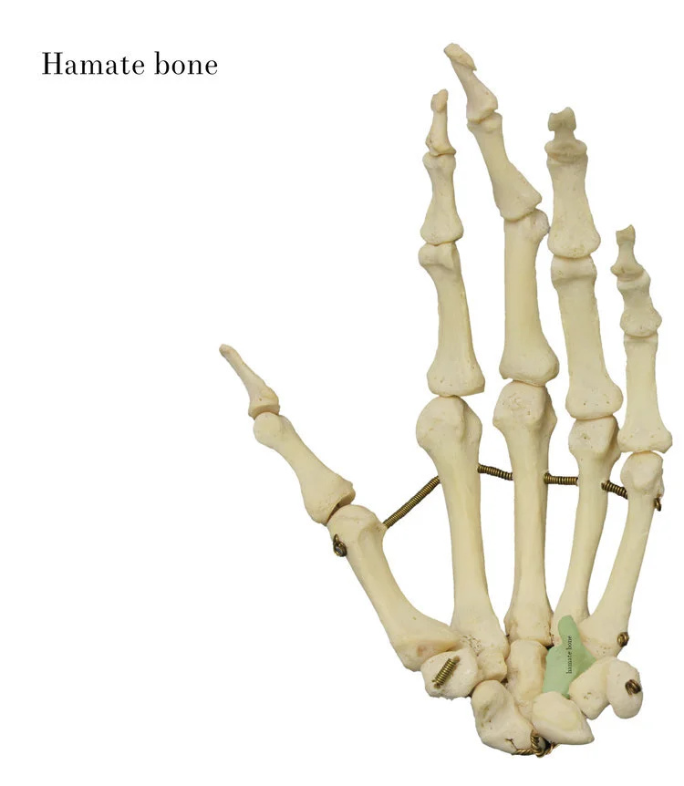 hamate_bone_labelled.jpg