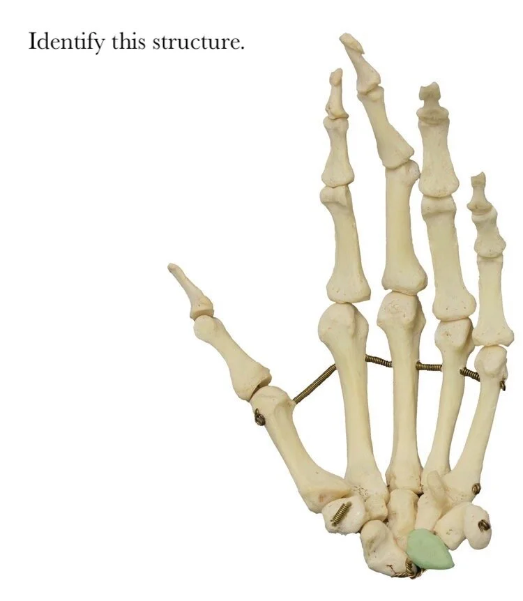 lunate_bone_identify.JPG