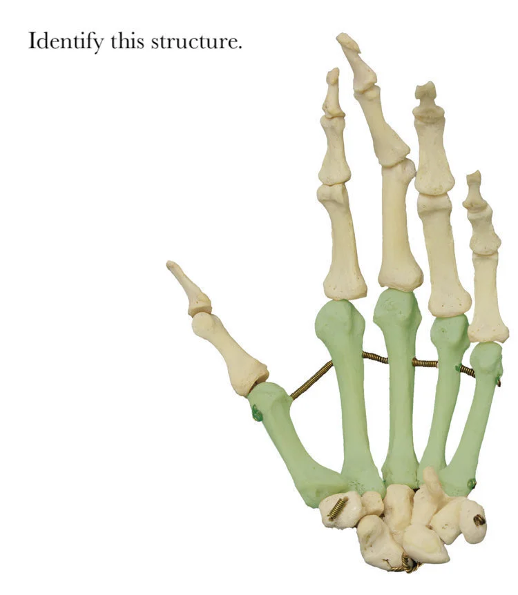 metacarpal_bones_identify.jpg